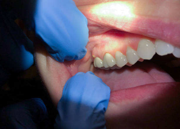Best Walk-In Emergency Dental Services in Rehobeth, AL